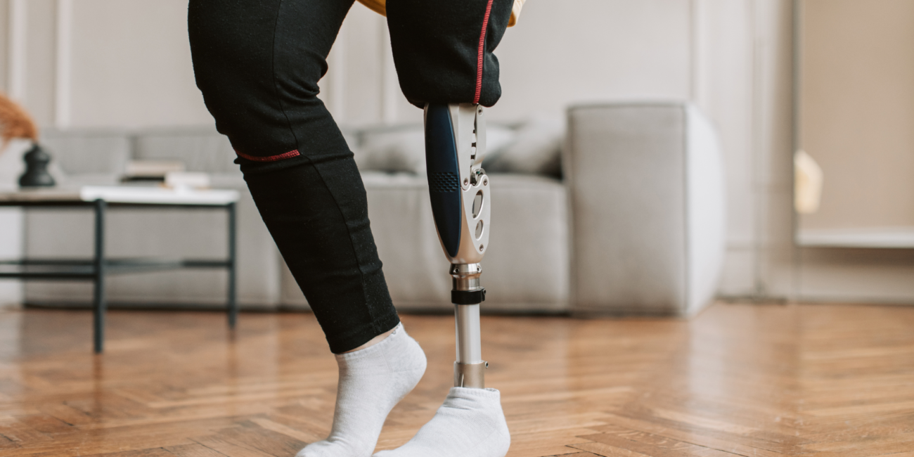 Person with Bionic leg